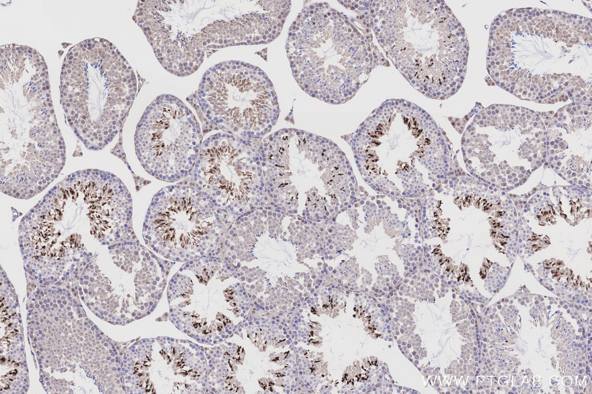 Immunohistochemical analysis of paraffin-embedded mouse testis tissue slide using KHC3206 (OPRM1 IHC Kit). Immunohistochemical analysis of paraffin-embedded mouse testis tissue slide using KHC3206 (OPRM1 IHC Kit).
