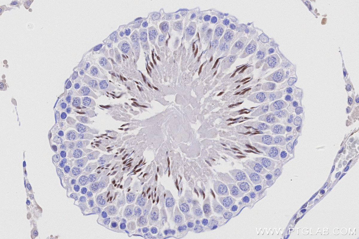 Immunohistochemical analysis of paraffin-embedded rat testis tissue slide using KHC3206 (OPRM1 IHC Kit). Immunohistochemical analysis of paraffin-embedded rat testis tissue slide using KHC3206 (OPRM1 IHC Kit).