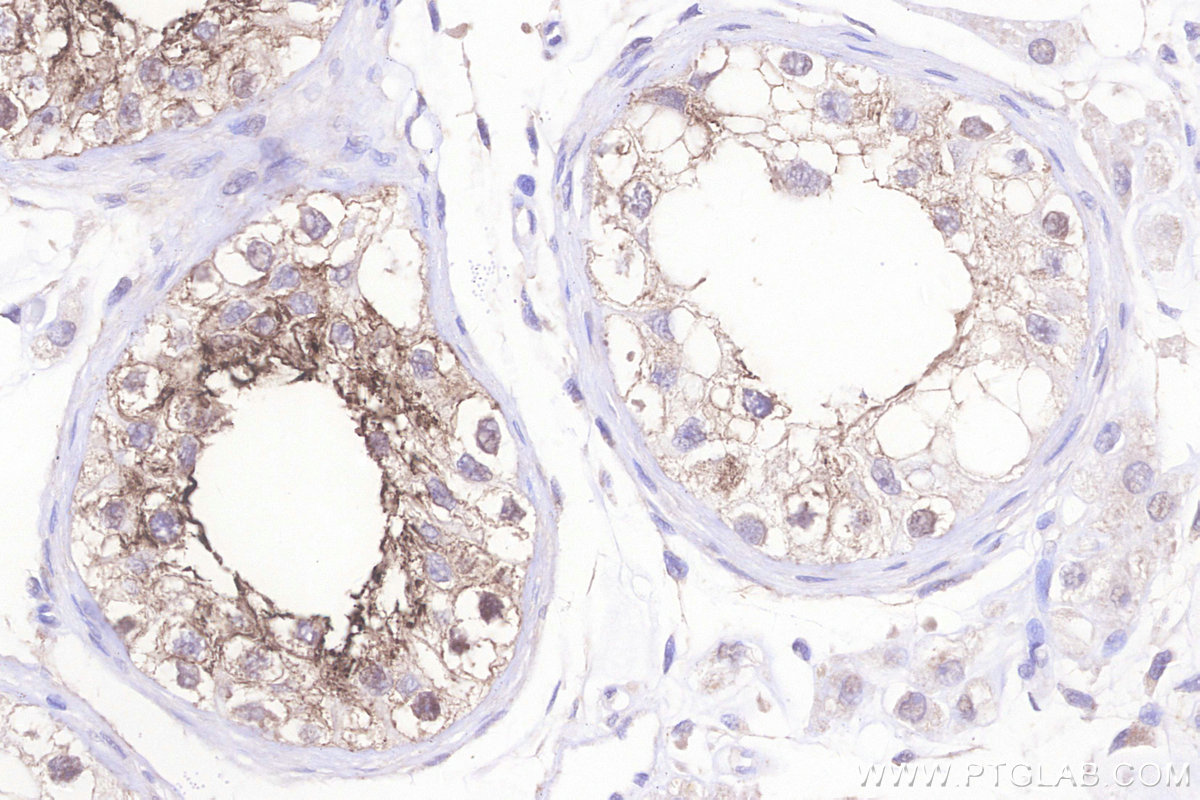 Immunohistochemical analysis of paraffin-embedded human testis tissue slide using KHC3206 (OPRM1 IHC Kit). Immunohistochemical analysis of paraffin-embedded human testis tissue slide using KHC3206 (OPRM1 IHC Kit).