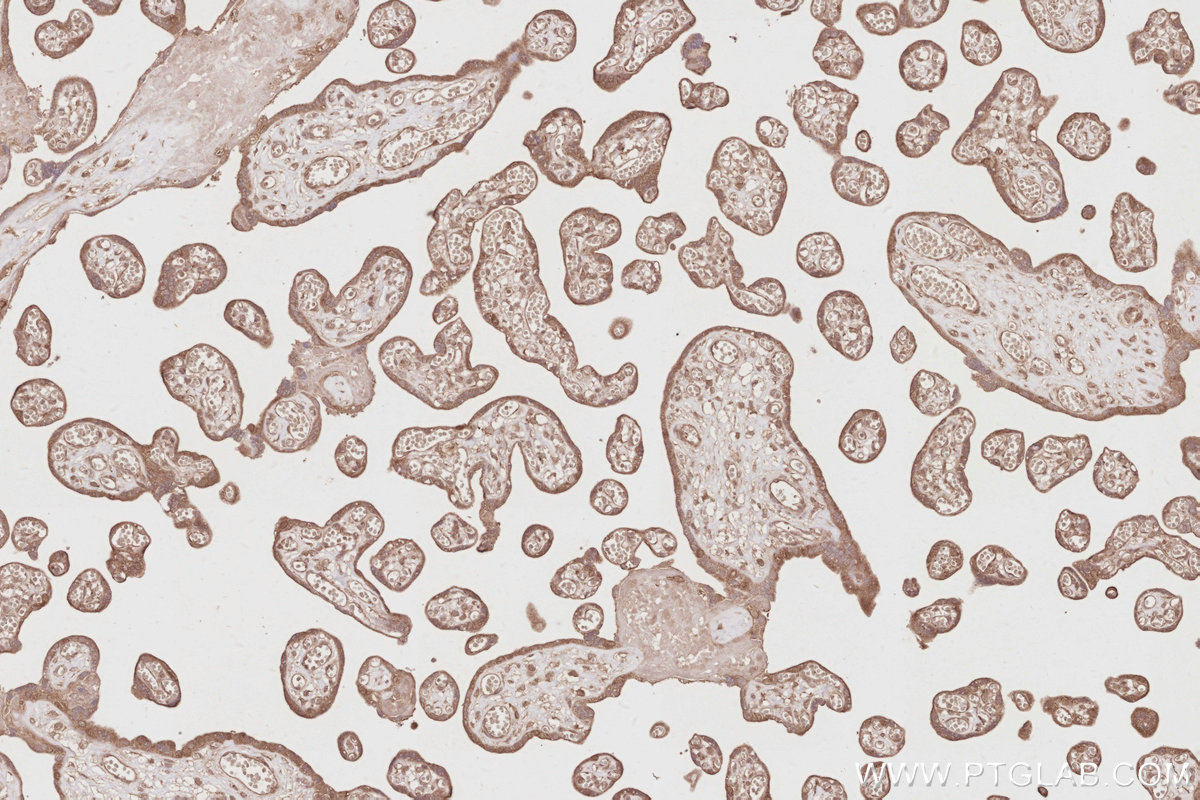 Immunohistochemical analysis of paraffin-embedded human placenta tissue slide using KHC2881 (OSBPL10 IHC Kit).