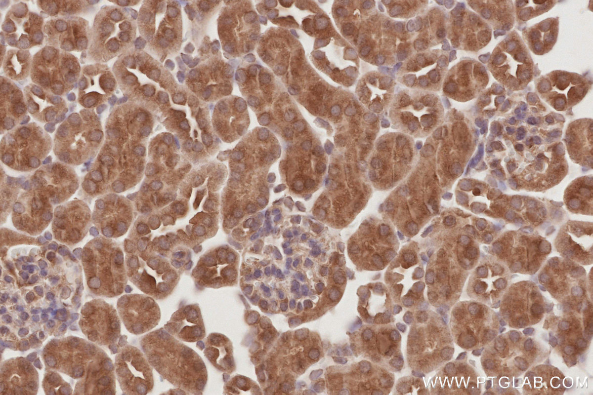 Immunohistochemical analysis of paraffin-embedded mouse kidney tissue slide using KHC2881 (OSBPL10 IHC Kit).
