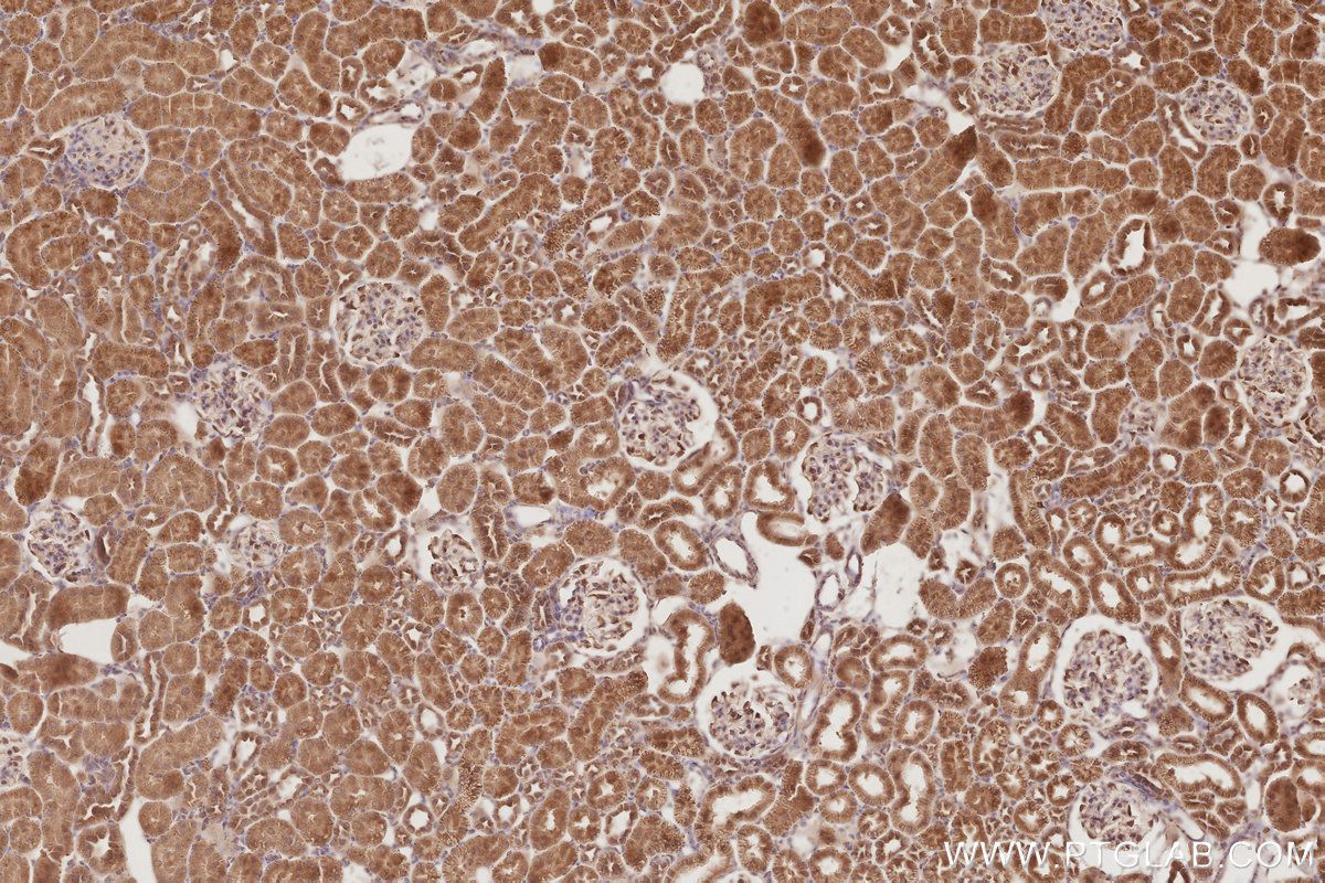 Immunohistochemical analysis of paraffin-embedded rat kidney tissue slide using KHC2881 (OSBPL10 IHC Kit).