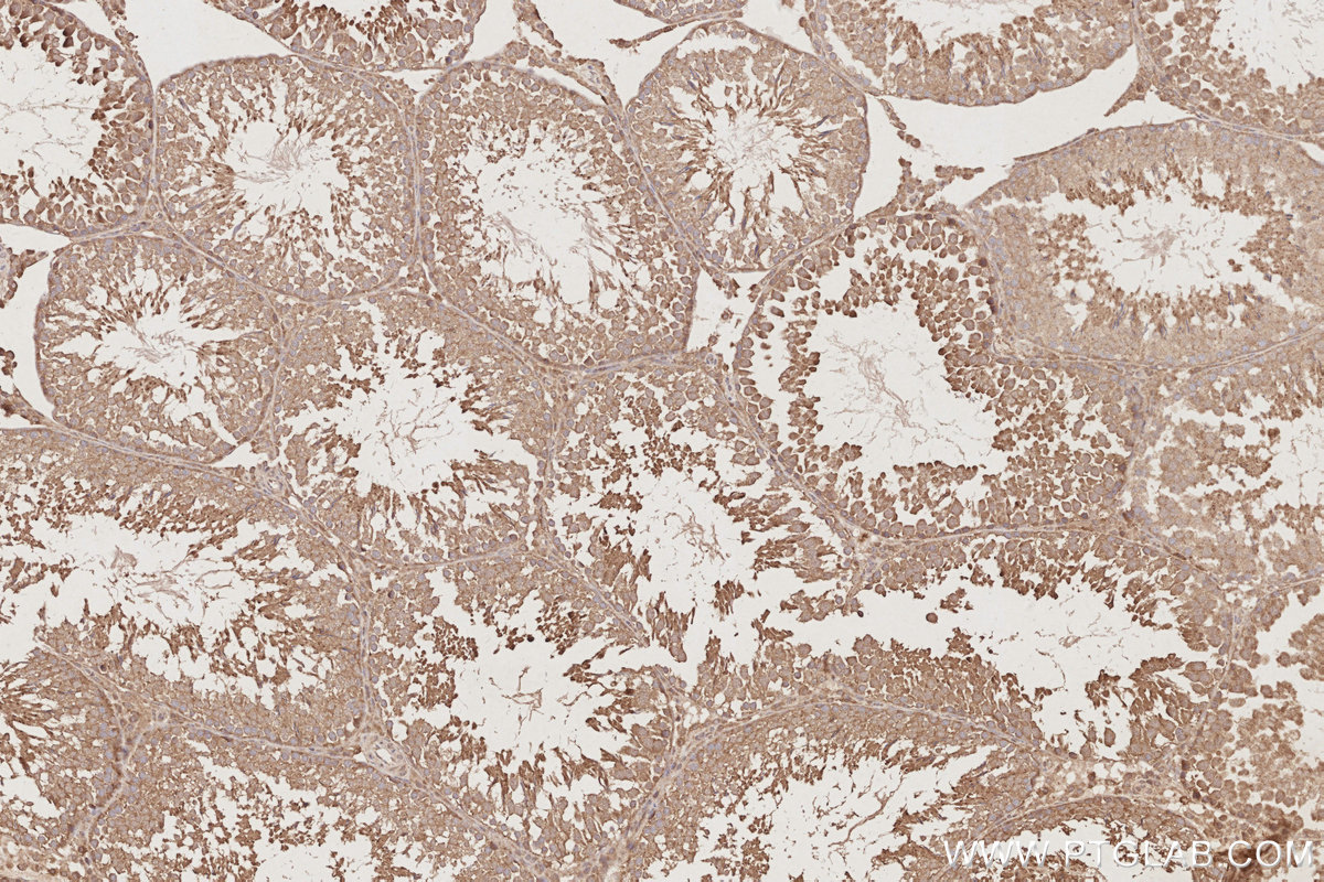 Immunohistochemical analysis of paraffin-embedded rat testis tissue slide using KHC2881 (OSBPL10 IHC Kit).