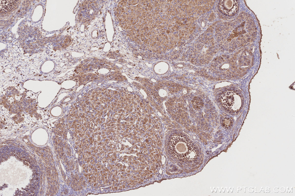 Immunohistochemical analysis of paraffin-embedded rat ovary tissue slide using KHC2880 (OSBPL11 IHC Kit).