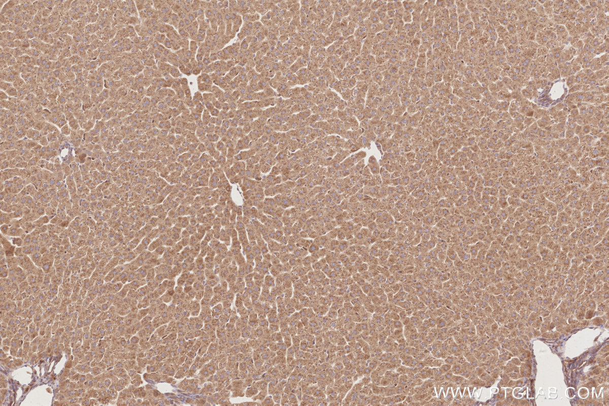 Immunohistochemical analysis of paraffin-embedded rat liver tissue slide using KHC2880 (OSBPL11 IHC Kit).