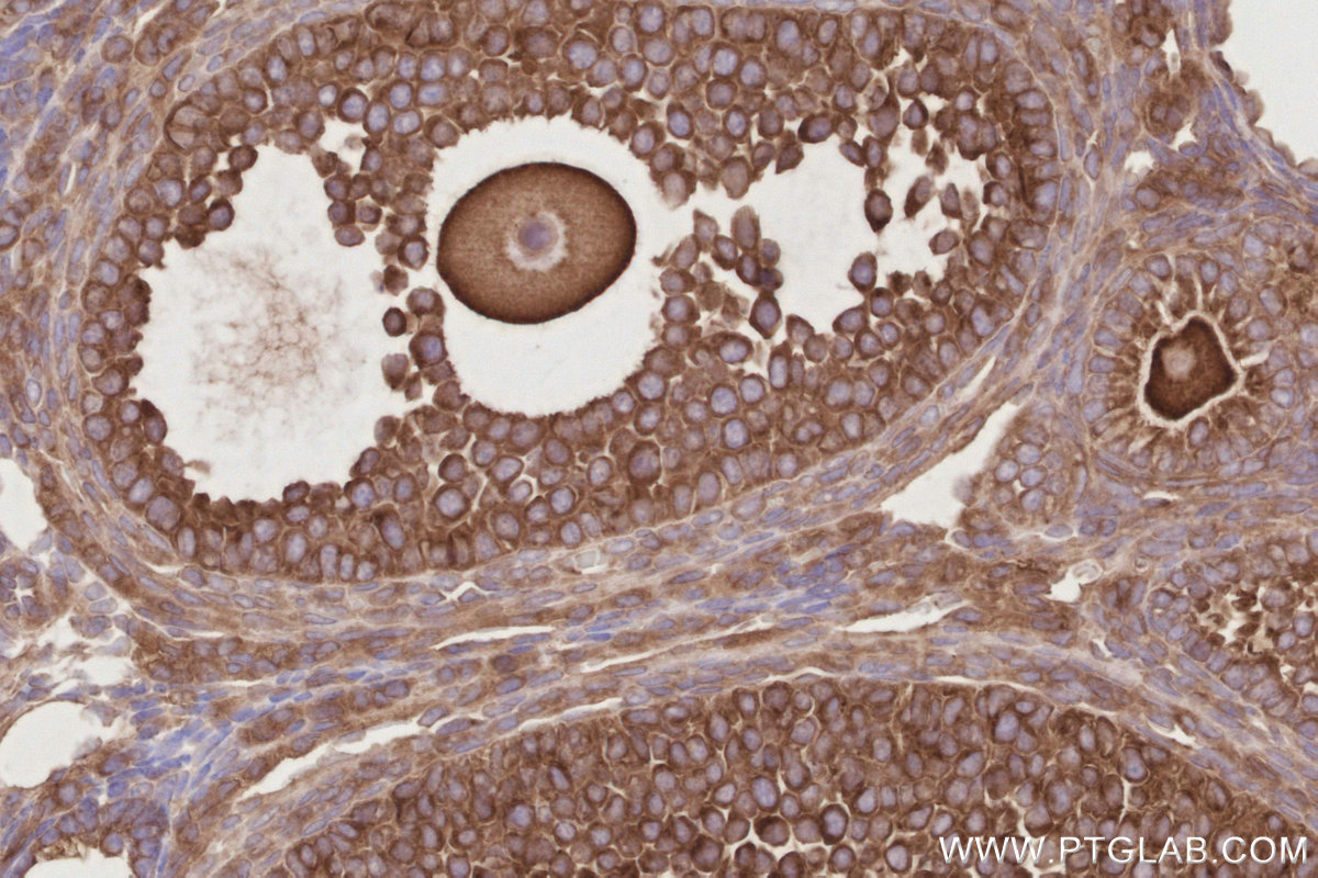 Immunohistochemical analysis of paraffin-embedded mouse ovary tissue slide using KHC2880 (OSBPL11 IHC Kit).