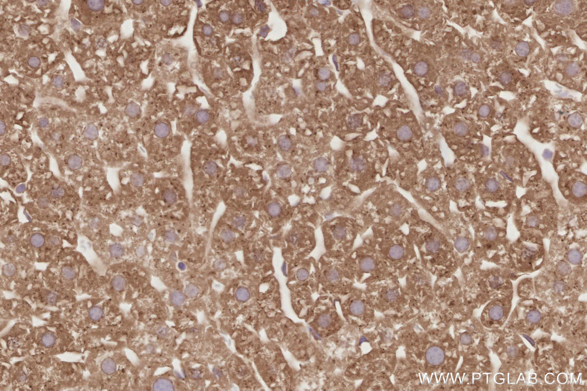 Immunohistochemical analysis of paraffin-embedded mouse liver tissue slide using KHC2880 (OSBPL11 IHC Kit).