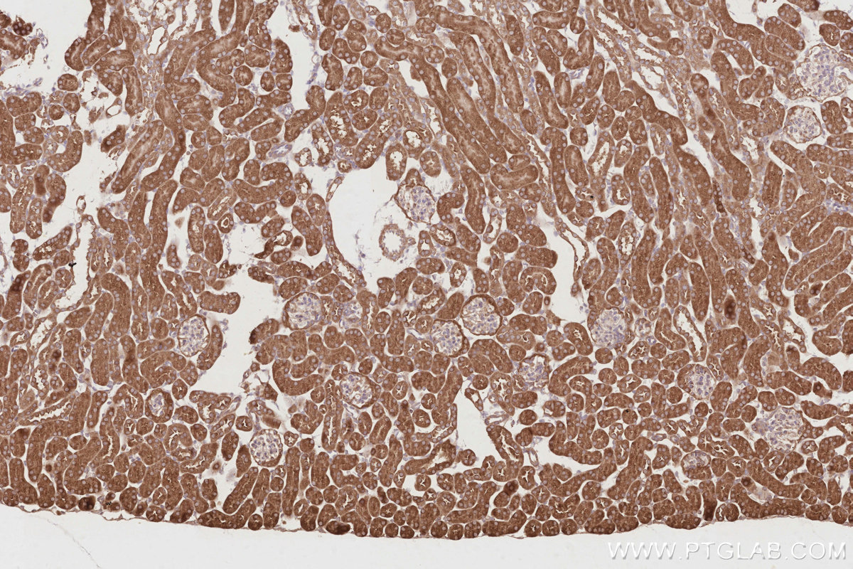 Immunohistochemical analysis of paraffin-embedded mouse kidney tissue slide using KHC2917 (OSBPL3 IHC Kit).