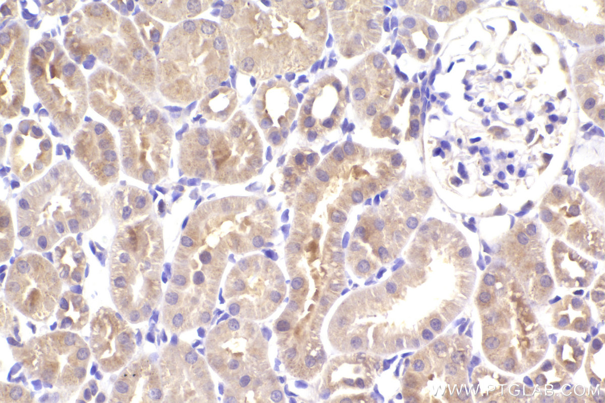 Immunohistochemical analysis of paraffin-embedded rat kidney tissue slide using KHC2917 (OSBPL3 IHC Kit).