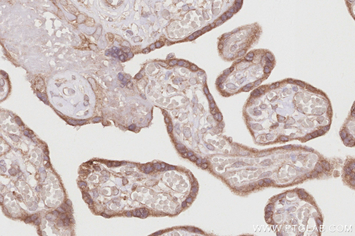 Immunohistochemical analysis of paraffin-embedded human placenta tissue slide using KHC2900 (OSBPL5 IHC Kit).