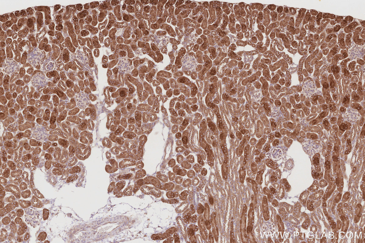 Immunohistochemical analysis of paraffin-embedded mouse kidney tissue slide using KHC2900 (OSBPL5 IHC Kit).