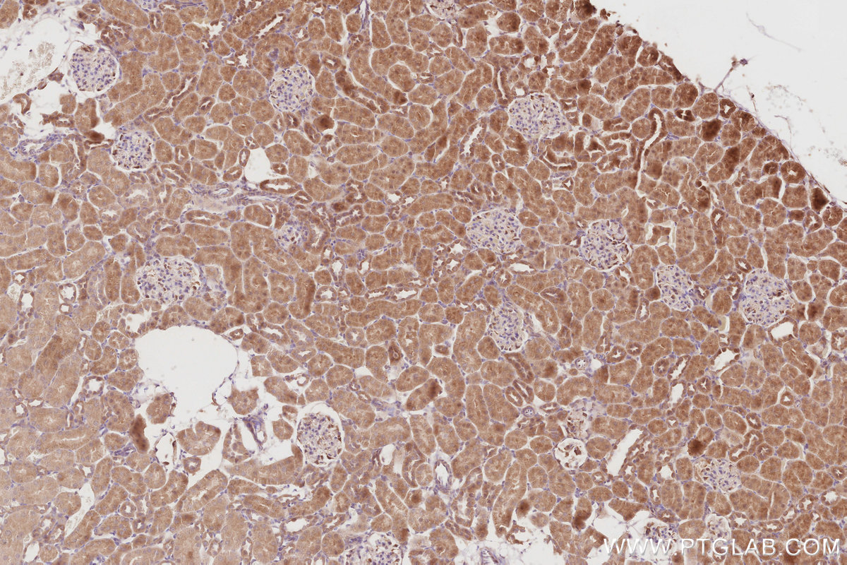 Immunohistochemical analysis of paraffin-embedded rat kidney tissue slide using KHC2900 (OSBPL5 IHC Kit).