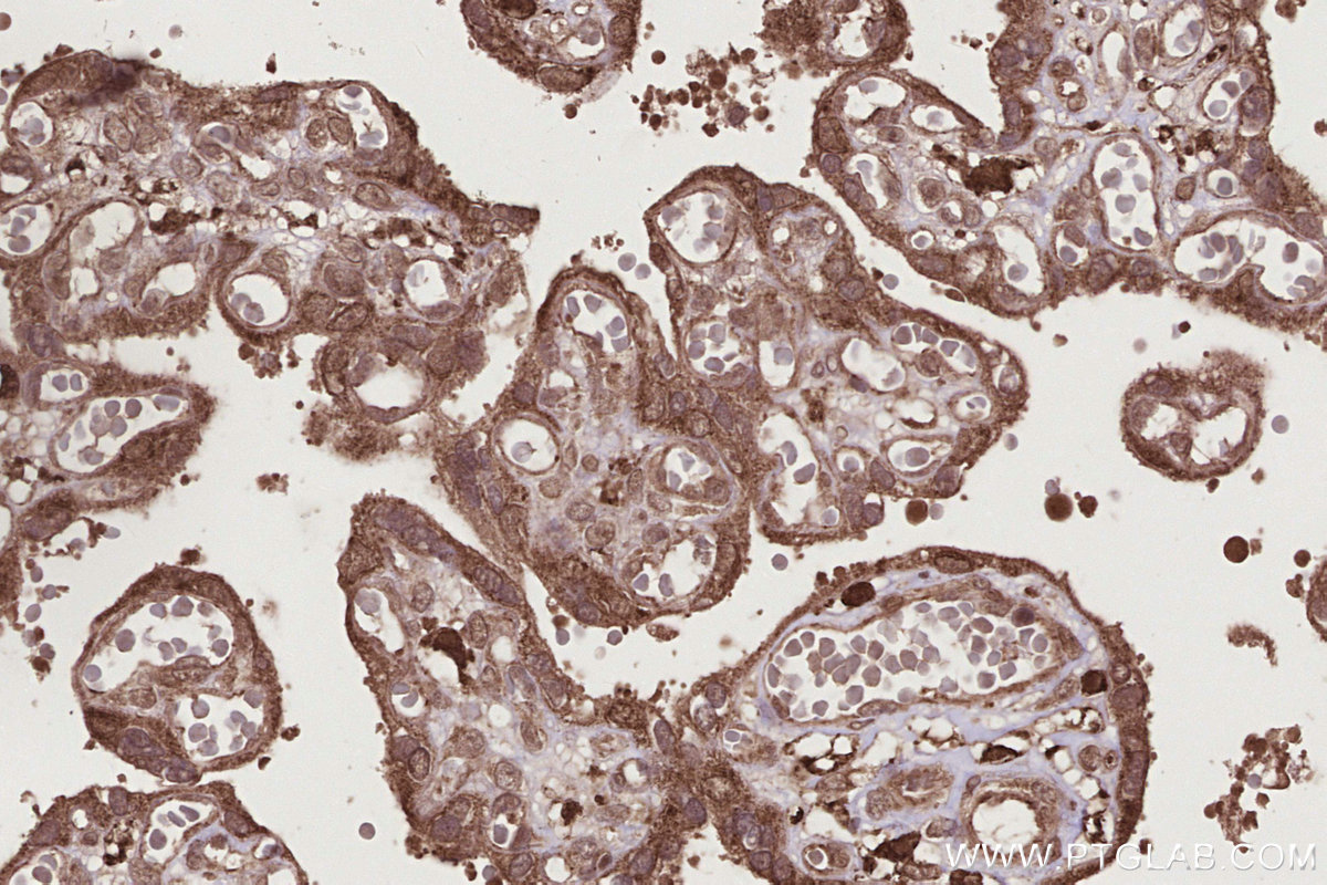Immunohistochemical analysis of paraffin-embedded human placenta tissue slide using KHC2793 (OTUD5 IHC Kit).