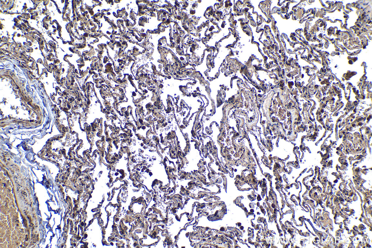 Immunohistochemical analysis of paraffin-embedded human lung tissue slide using KHC1369 (P4HA2 IHC Kit).