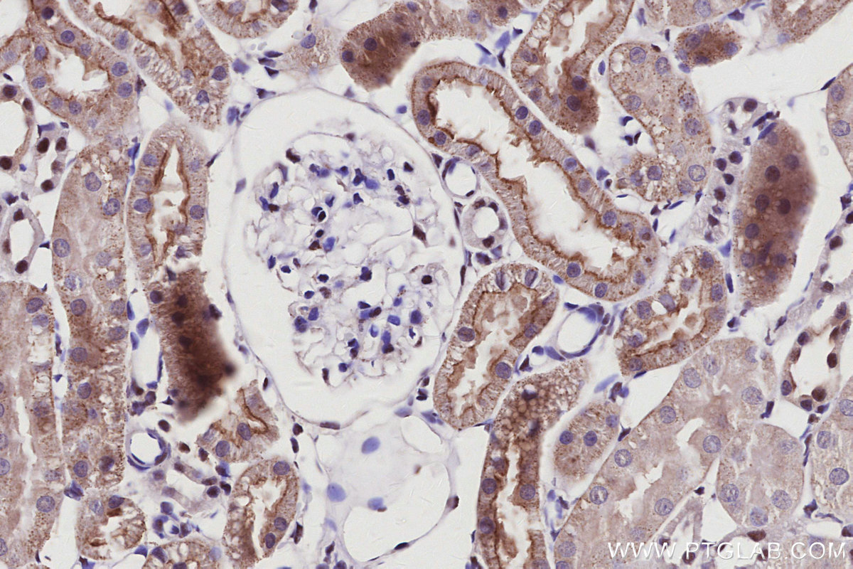 Immunohistochemical analysis of paraffin-embedded rat kidney tissue slide using KHC2944 (PAK6 IHC Kit).