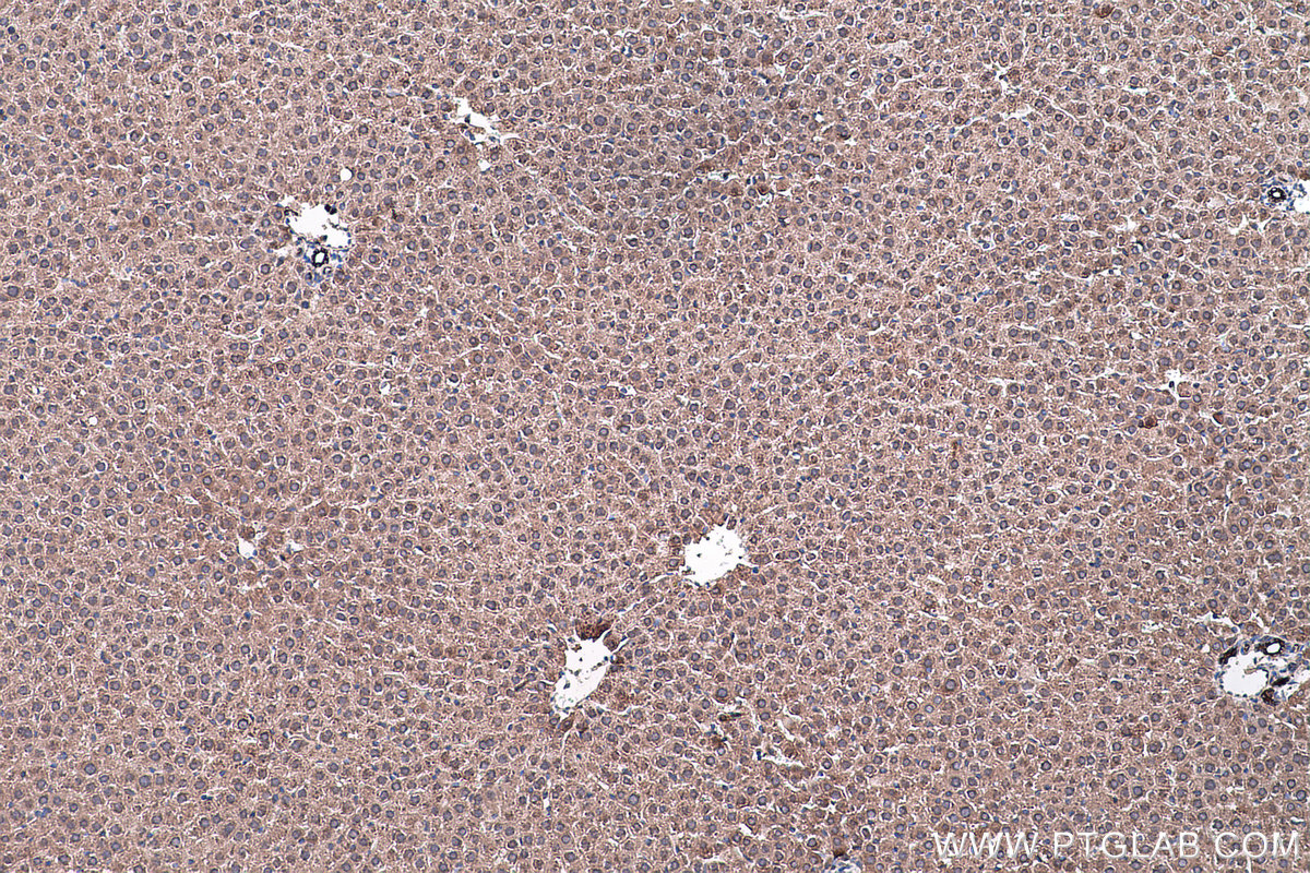 Immunohistochemical analysis of paraffin-embedded rat liver tissue slide using KHC0443 (PALMD IHC Kit).