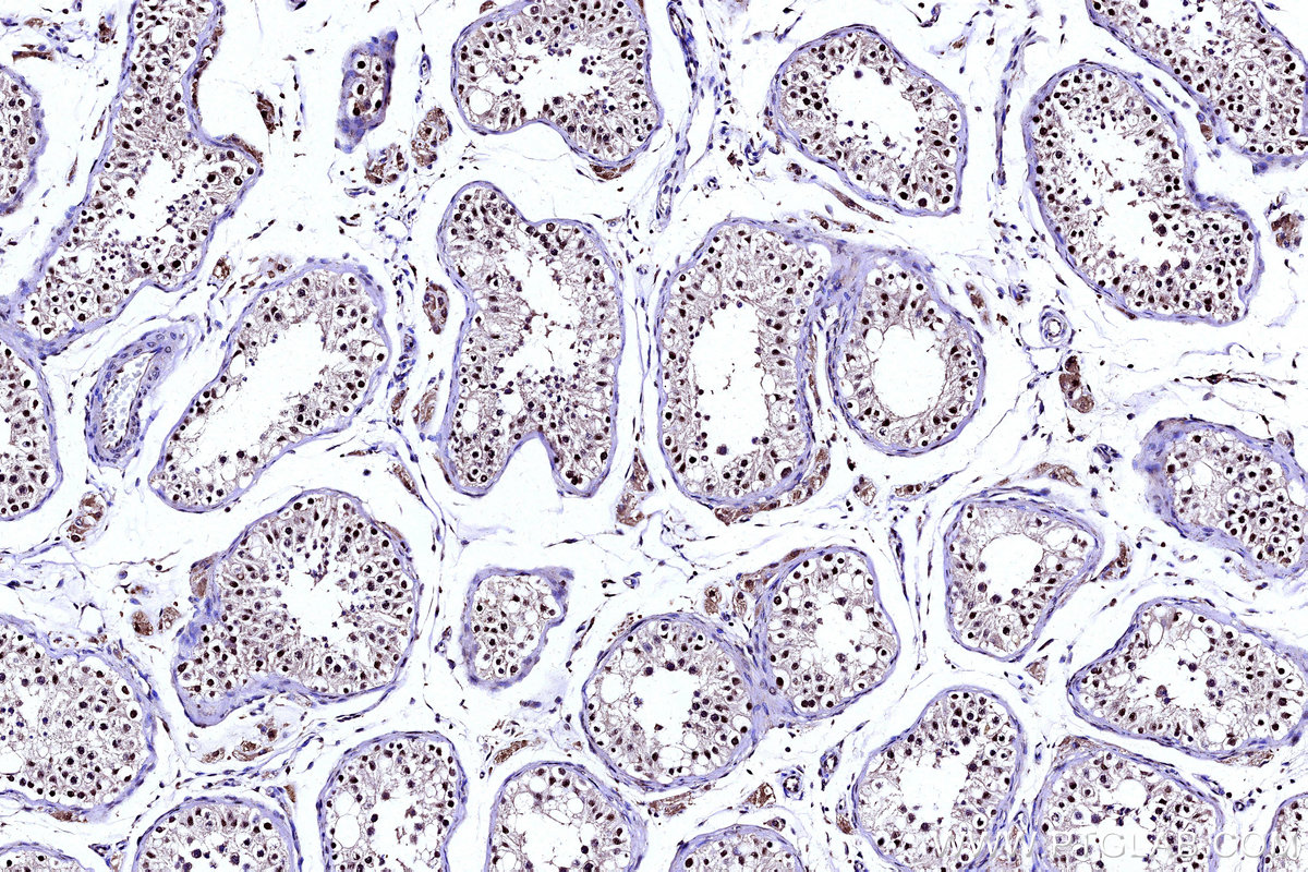 Immunohistochemical analysis of paraffin-embedded human testis tissue slide using KHC3141 (PAPSS1 IHC Kit). Immunohistochemical analysis of paraffin-embedded human testis tissue slide using KHC3141 (PAPSS1 IHC Kit).