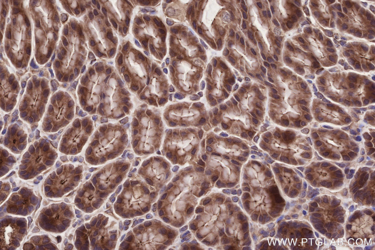 Immunohistochemical analysis of paraffin-embedded mouse stomach tissue slide using KHC2726 (PARD3 IHC Kit).
