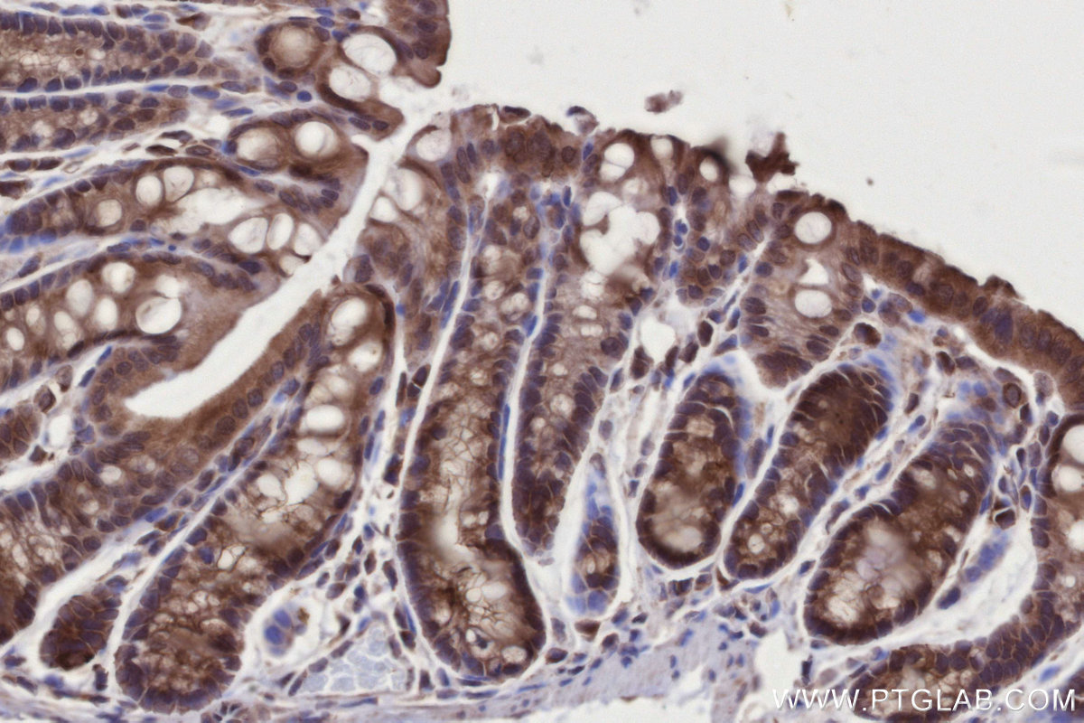 Immunohistochemical analysis of paraffin-embedded mouse colon tissue slide using KHC2726 (PARD3 IHC Kit).