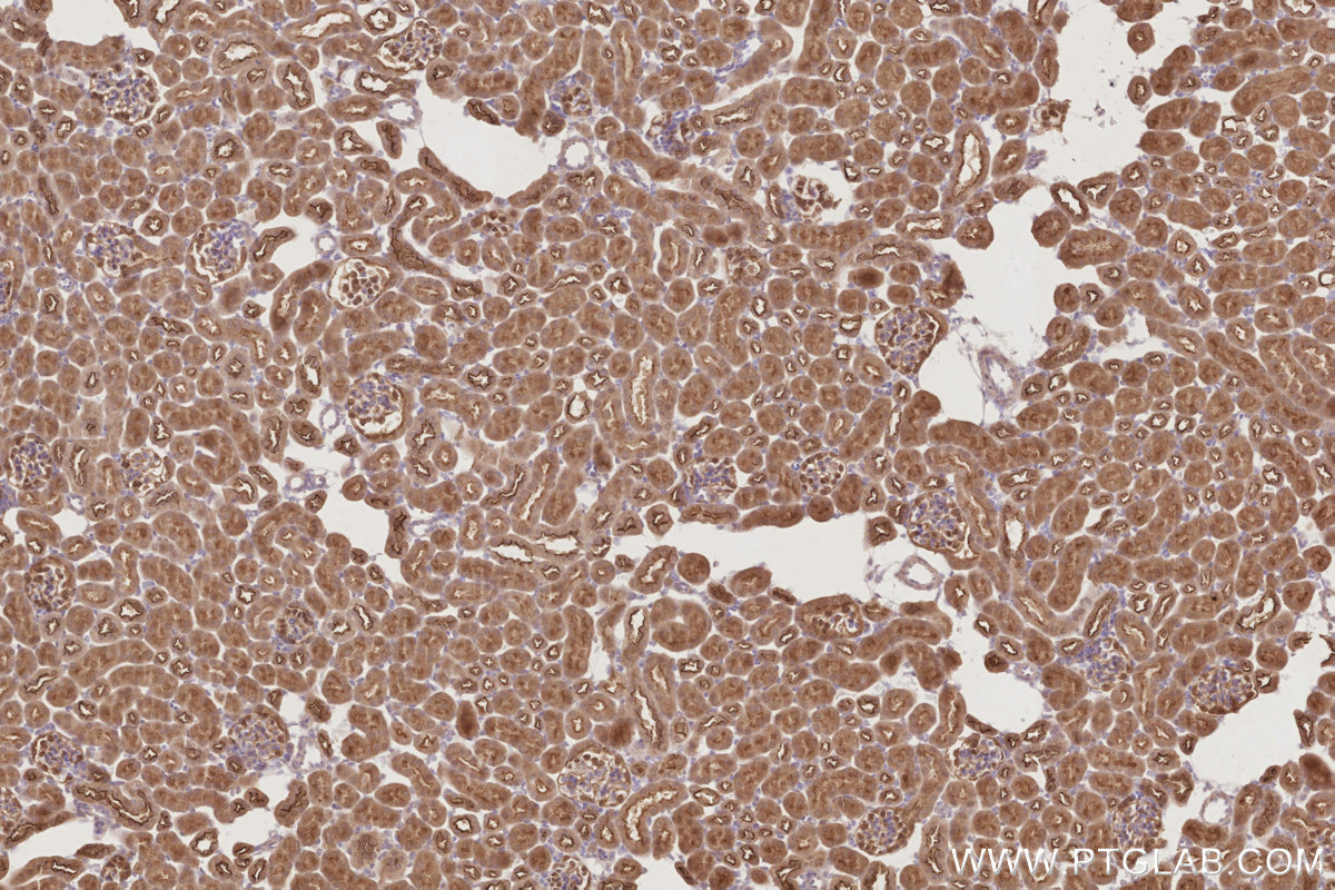 Immunohistochemical analysis of paraffin-embedded mouse kidney tissue slide using KHC2887 (PARD6B IHC Kit). Immunohistochemical analysis of paraffin-embedded mouse kidney tissue slide using KHC2887 (PARD6B IHC Kit).