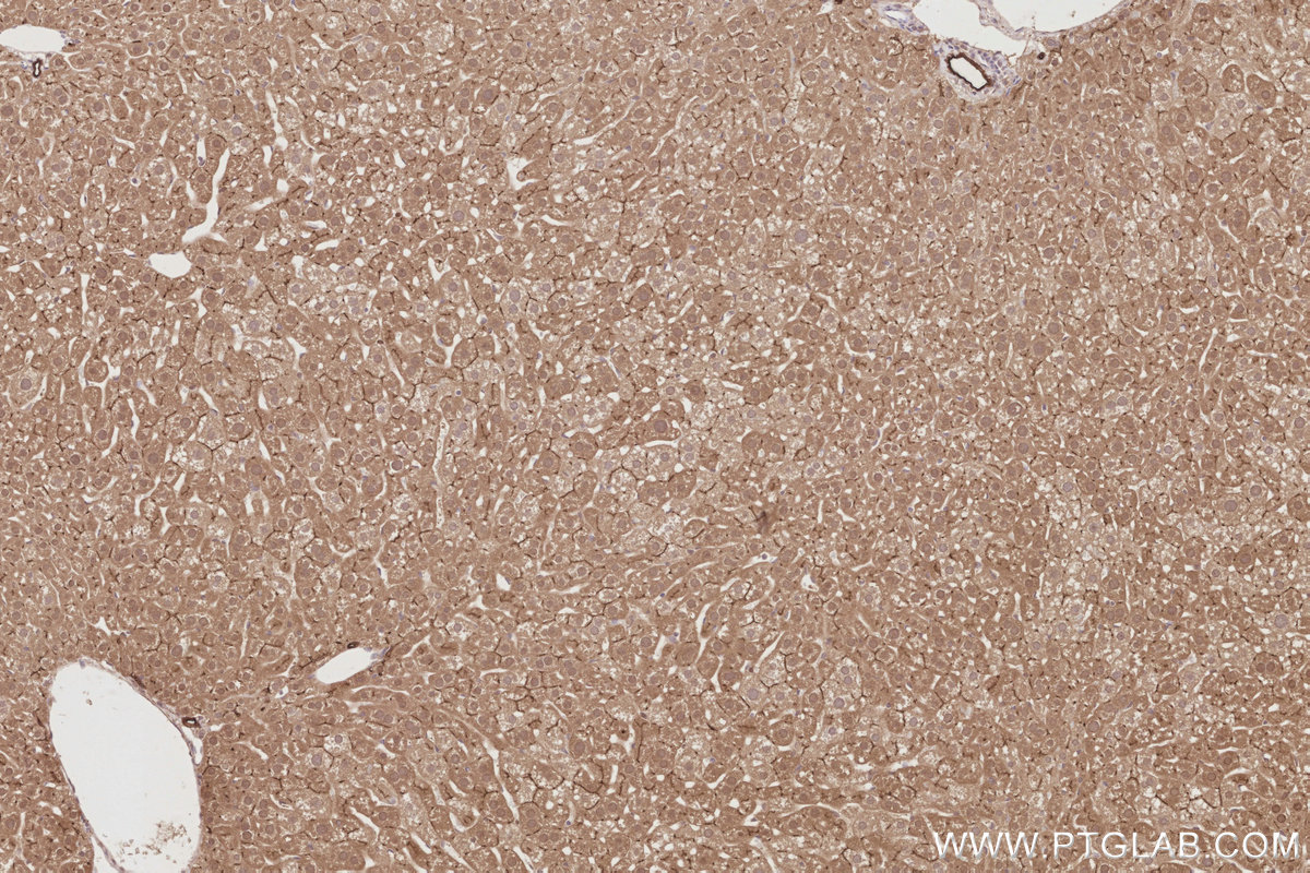 Immunohistochemical analysis of paraffin-embedded mouse liver tissue slide using KHC2887 (PARD6B IHC Kit). Immunohistochemical analysis of paraffin-embedded mouse liver tissue slide using KHC2887 (PARD6B IHC Kit).