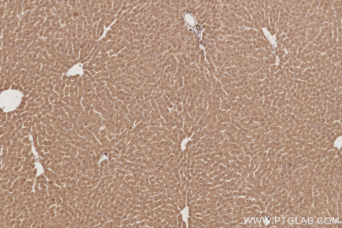 Immunohistochemical analysis of paraffin-embedded rat liver tissue slide using KHC2887 (PARD6B IHC Kit). Immunohistochemical analysis of paraffin-embedded rat liver tissue slide using KHC2887 (PARD6B IHC Kit).