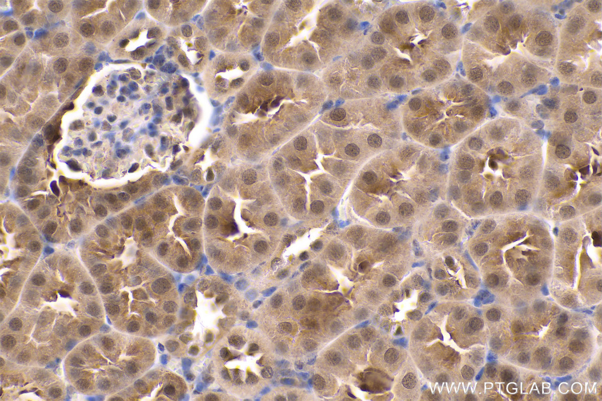 Immunohistochemical analysis of paraffin-embedded mouse kidney tissue slide using KHC0557 (PARK7 IHC Kit).