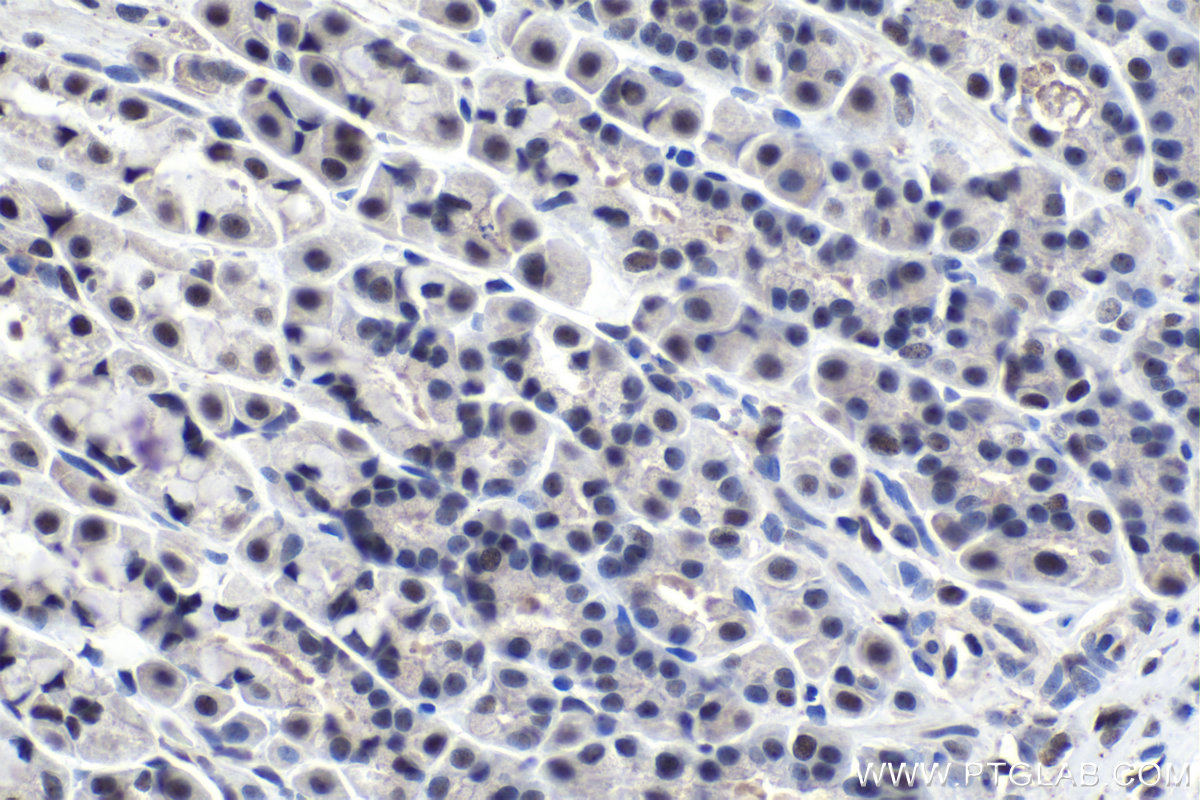 Immunohistochemical analysis of paraffin-embedded rat stomach tissue slide using KHC1016 (PARN IHC Kit).