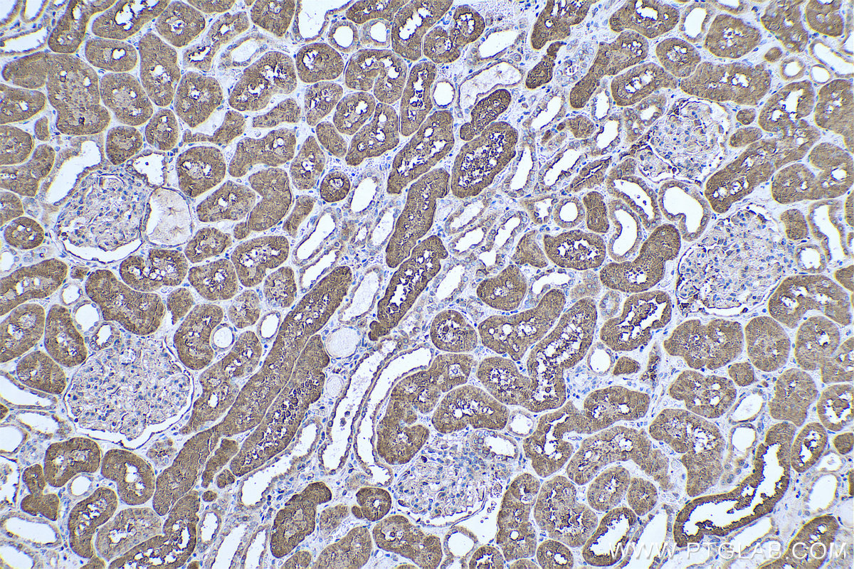 Immunohistochemical analysis of paraffin-embedded human kidney tissue slide using KHC0720 (PARVA IHC Kit).