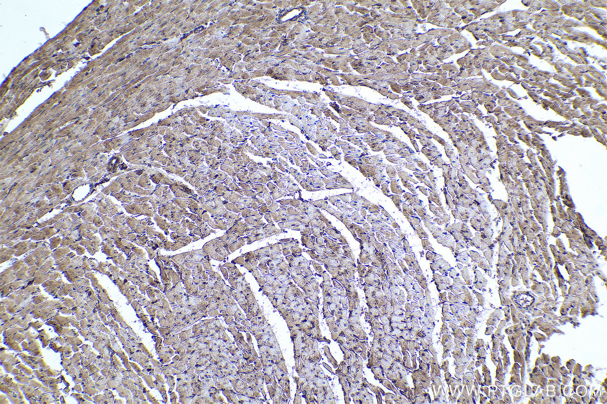 Immunohistochemical analysis of paraffin-embedded rat heart tissue slide using KHC0720 (PARVA IHC Kit).