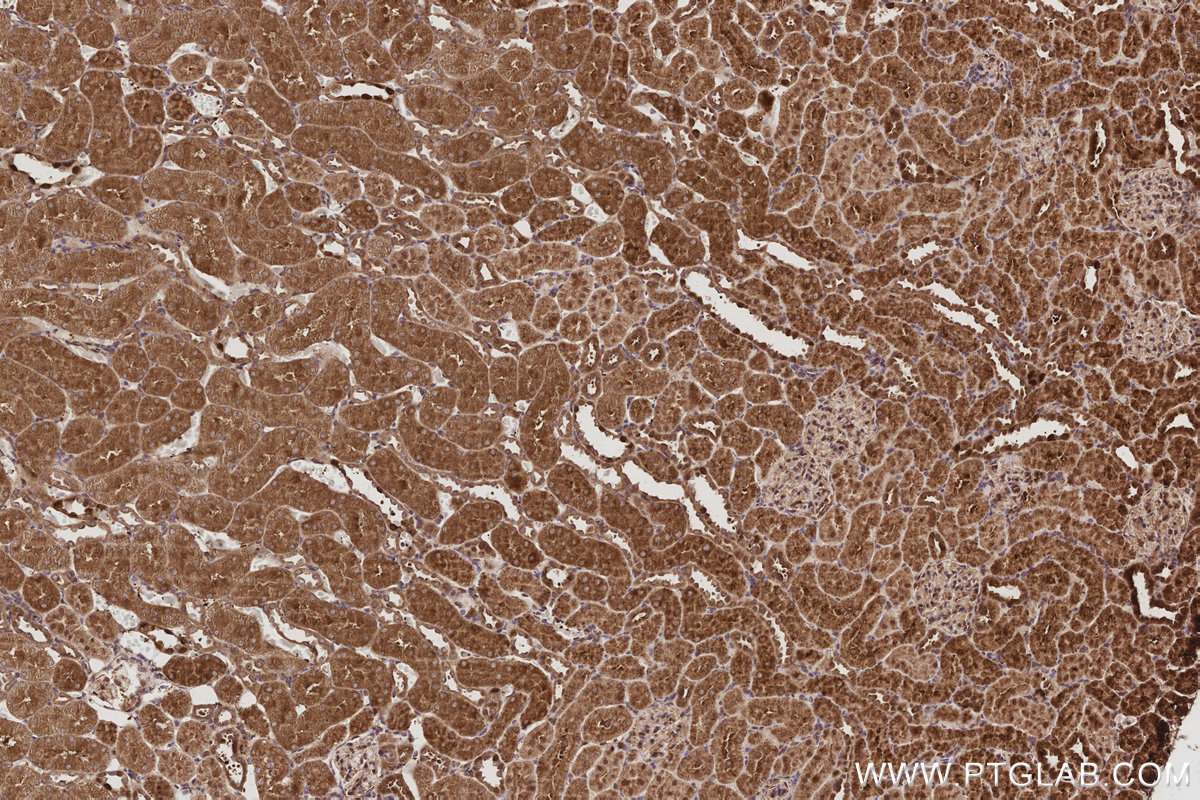 Immunohistochemical analysis of paraffin-embedded rat kidney tissue slide using KHC2960 (PARVB IHC Kit). Immunohistochemical analysis of paraffin-embedded rat kidney tissue slide using KHC2960 (PARVB IHC Kit).