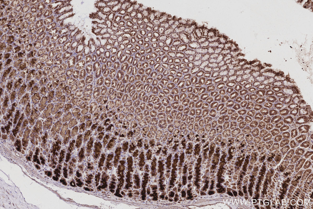 Immunohistochemical analysis of paraffin-embedded rat stomach tissue slide using KHC2960 (PARVB IHC Kit). Immunohistochemical analysis of paraffin-embedded rat stomach tissue slide using KHC2960 (PARVB IHC Kit).