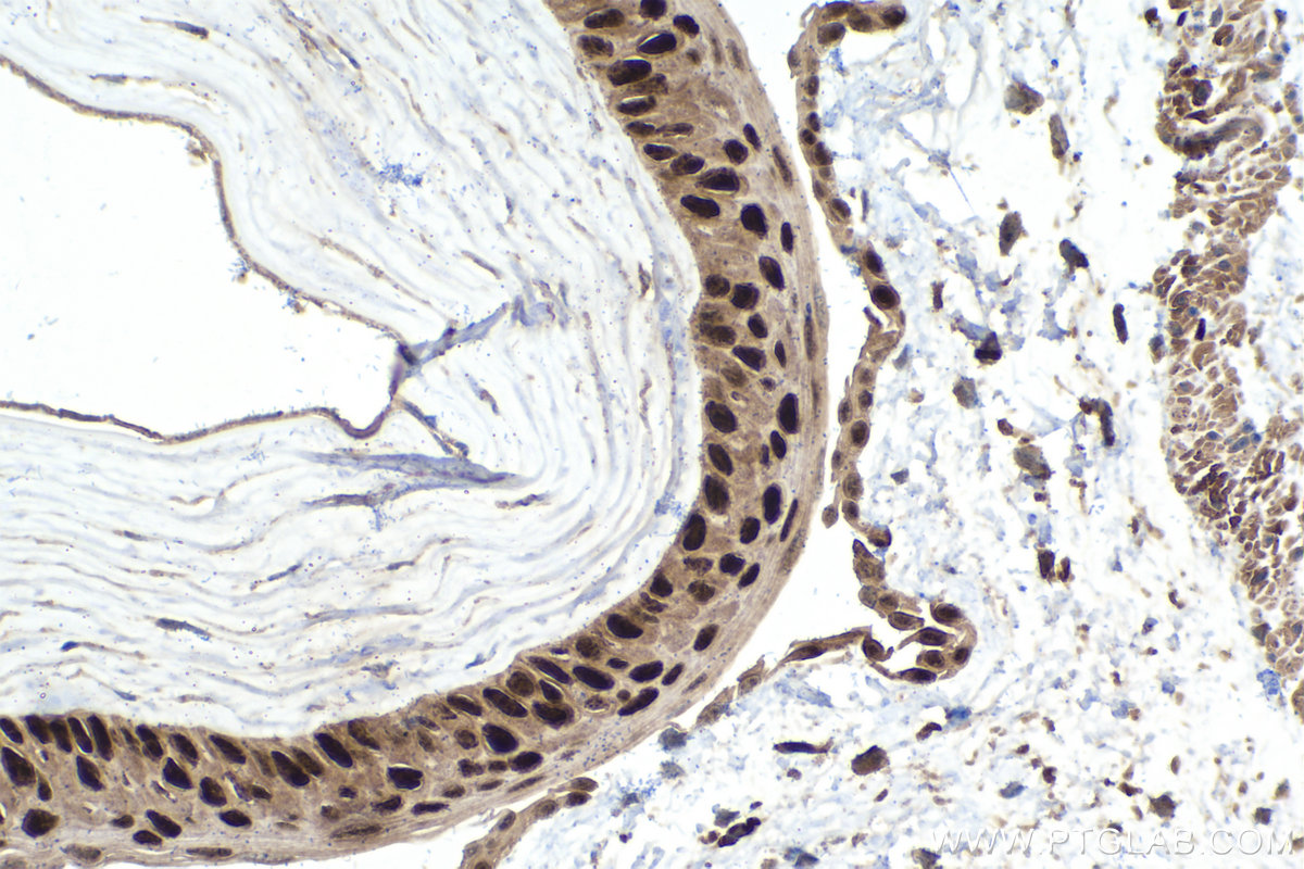 Immunohistochemical analysis of paraffin-embedded mouse eye tissue slide using KHC1565 (PAX6 IHC Kit).