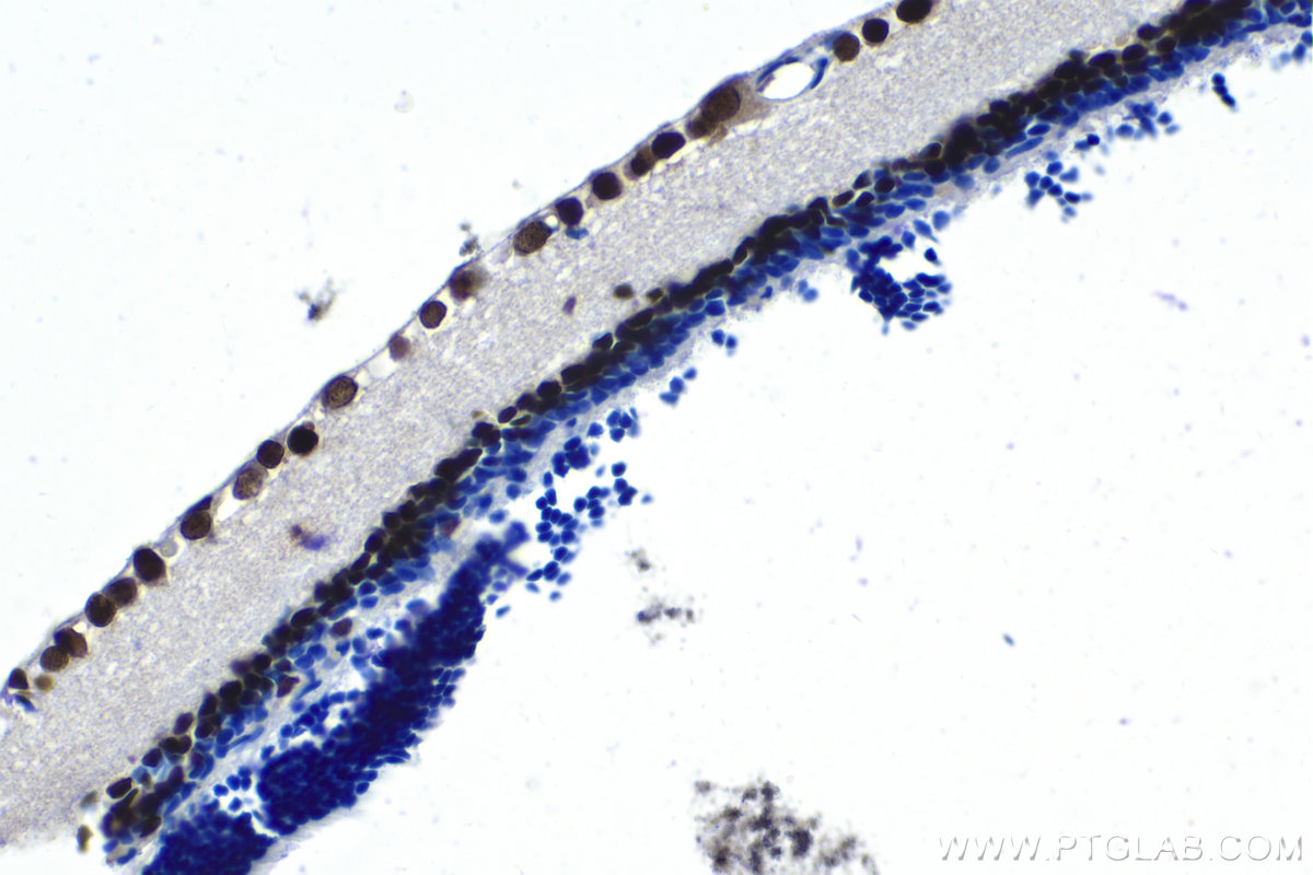 Immunohistochemical analysis of paraffin-embedded rat eye tissue slide using KHC1565 (PAX6 IHC Kit).