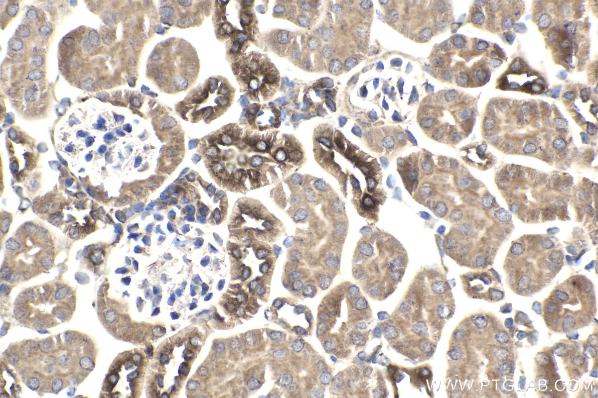 Immunohistochemical analysis of paraffin-embedded mouse kidney tissue slide using KHC1866 (PBXIP1 IHC Kit).