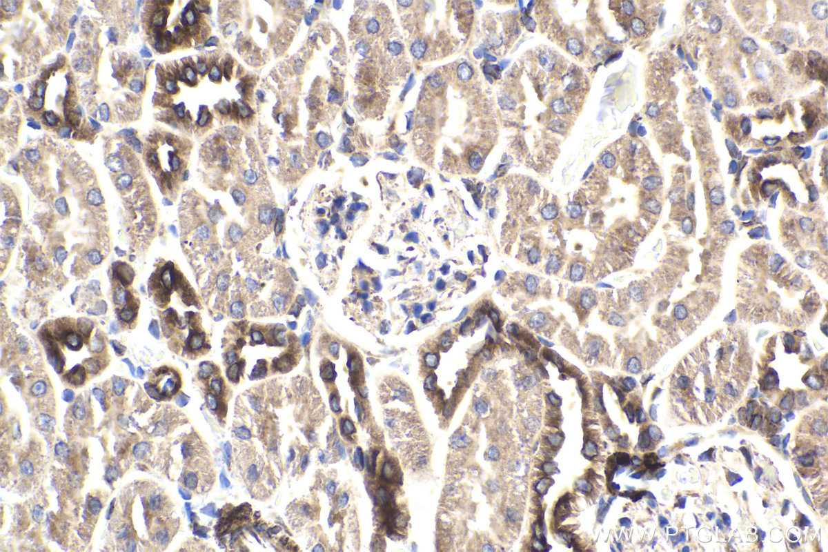 Immunohistochemical analysis of paraffin-embedded rat kidney tissue slide using KHC1866 (PBXIP1 IHC Kit).