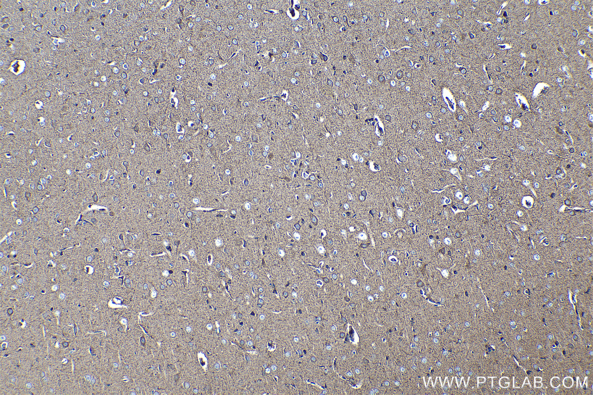 Immunohistochemical analysis of paraffin-embedded rat brain tissue slide using KHC1266 (PC IHC Kit).