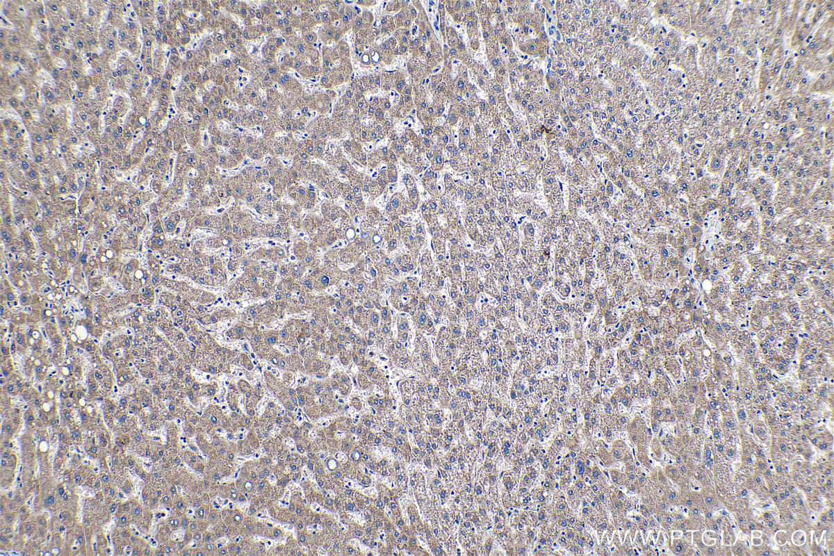 Immunohistochemical analysis of paraffin-embedded human liver tissue slide using KHC1266 (PC IHC Kit).