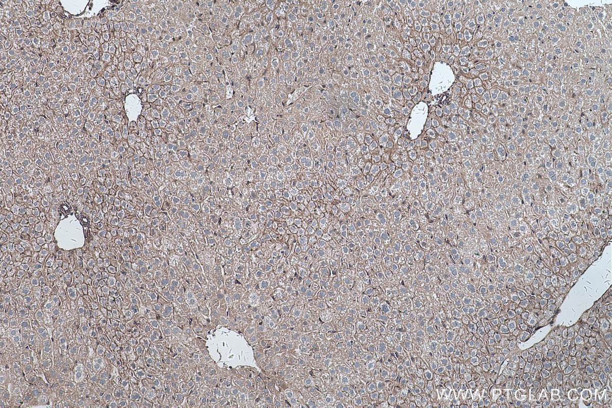 Immunohistochemical analysis of paraffin-embedded mouse liver tissue slide using KHC0258 (PCDH24 IHC Kit).