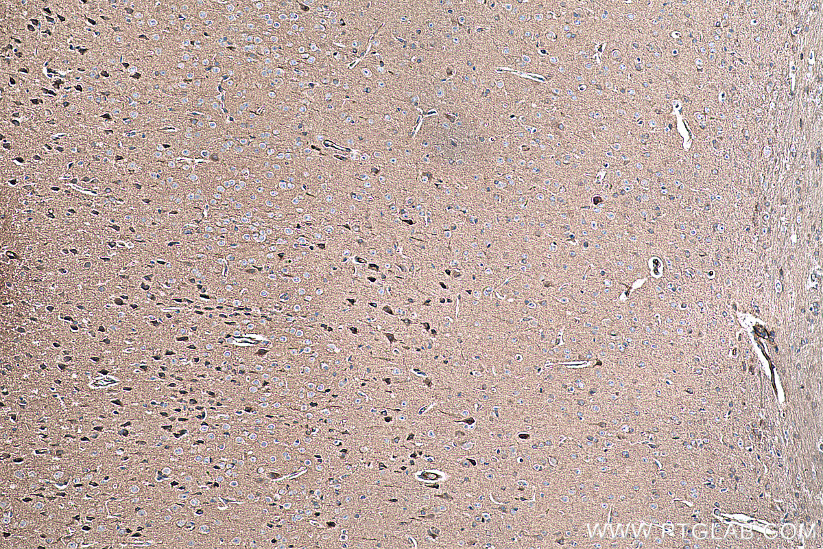 Immunohistochemical analysis of paraffin-embedded mouse brain tissue slide using KHC0297 (PCDHA3 IHC Kit).