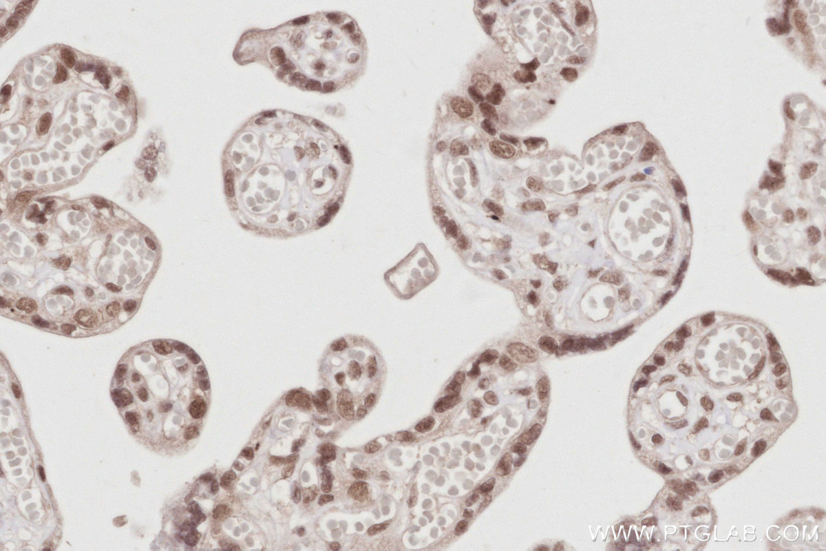 Immunohistochemical analysis of paraffin-embedded human placenta tissue slide using KHC2886 (PCGF6 IHC Kit).