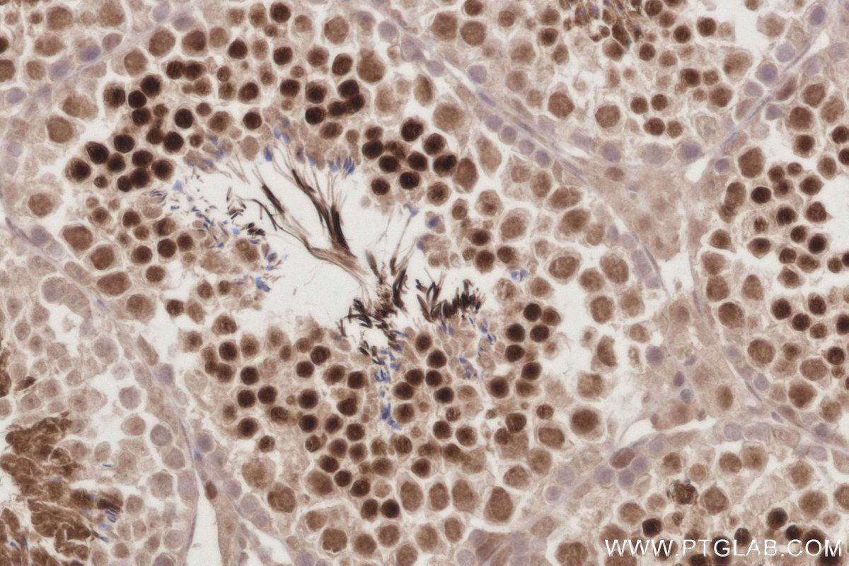 Immunohistochemical analysis of paraffin-embedded mouse testis tissue slide using KHC2886 (PCGF6 IHC Kit).