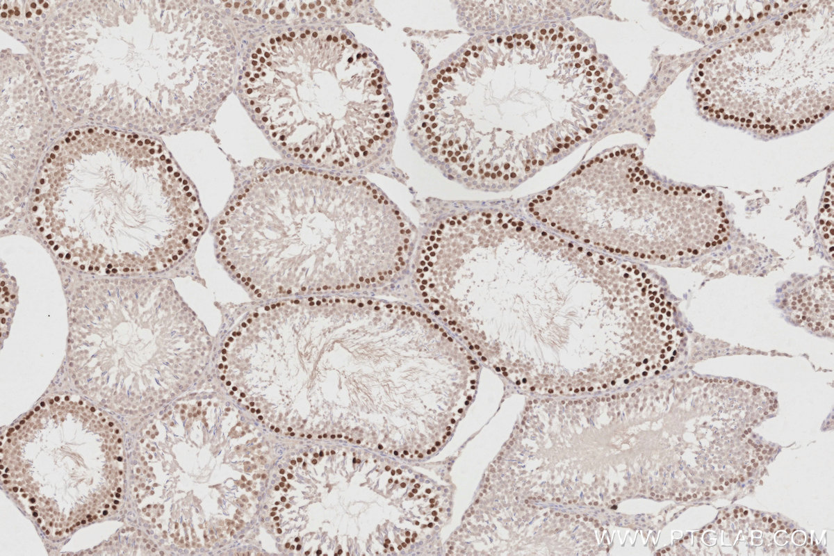 Immunohistochemical analysis of paraffin-embedded rat testis tissue slide using KHC2886 (PCGF6 IHC Kit).