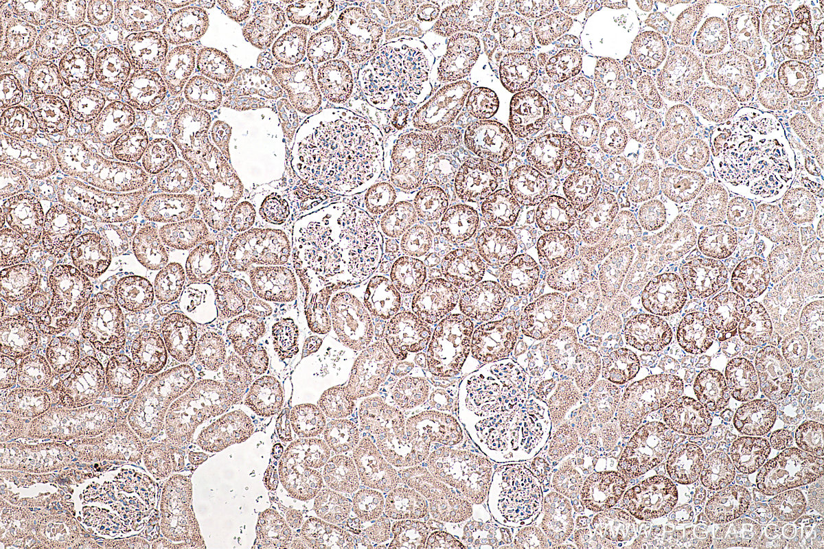 Immunohistochemical analysis of paraffin-embedded rat kidney tissue slide using KHC0232 (PCK2 IHC Kit).