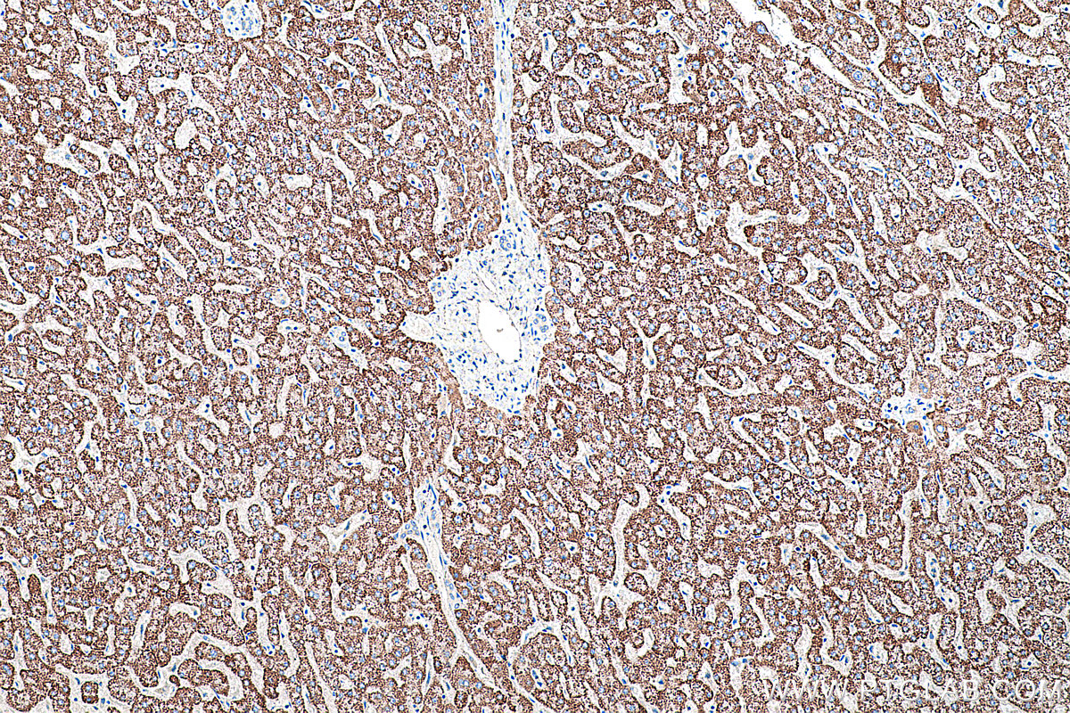 Immunohistochemical analysis of paraffin-embedded human liver tissue slide using KHC0232 (PCK2 IHC Kit).