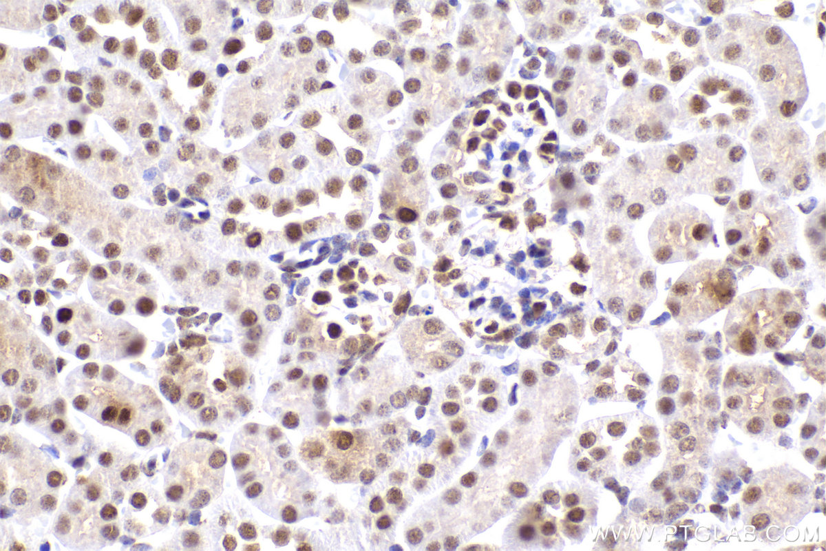 Immunohistochemical analysis of paraffin-embedded mouse kidney tissue slide using KHC2182 (PCNA IHC Kit).