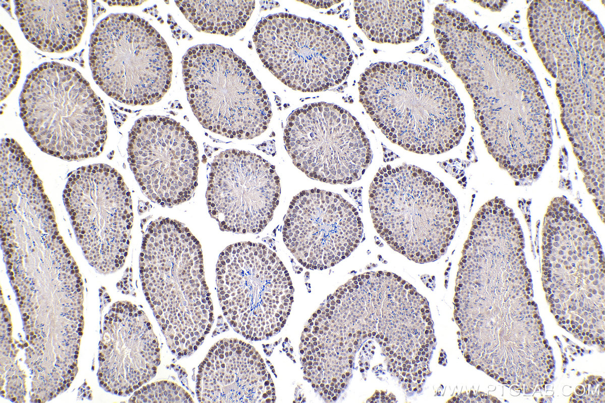 Immunohistochemical analysis of paraffin-embedded mouse testis tissue slide using KHC2182 (PCNA IHC Kit).