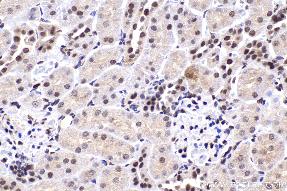 Immunohistochemical analysis of paraffin-embedded rat kidney tissue slide using KHC2182 (PCNA IHC Kit).