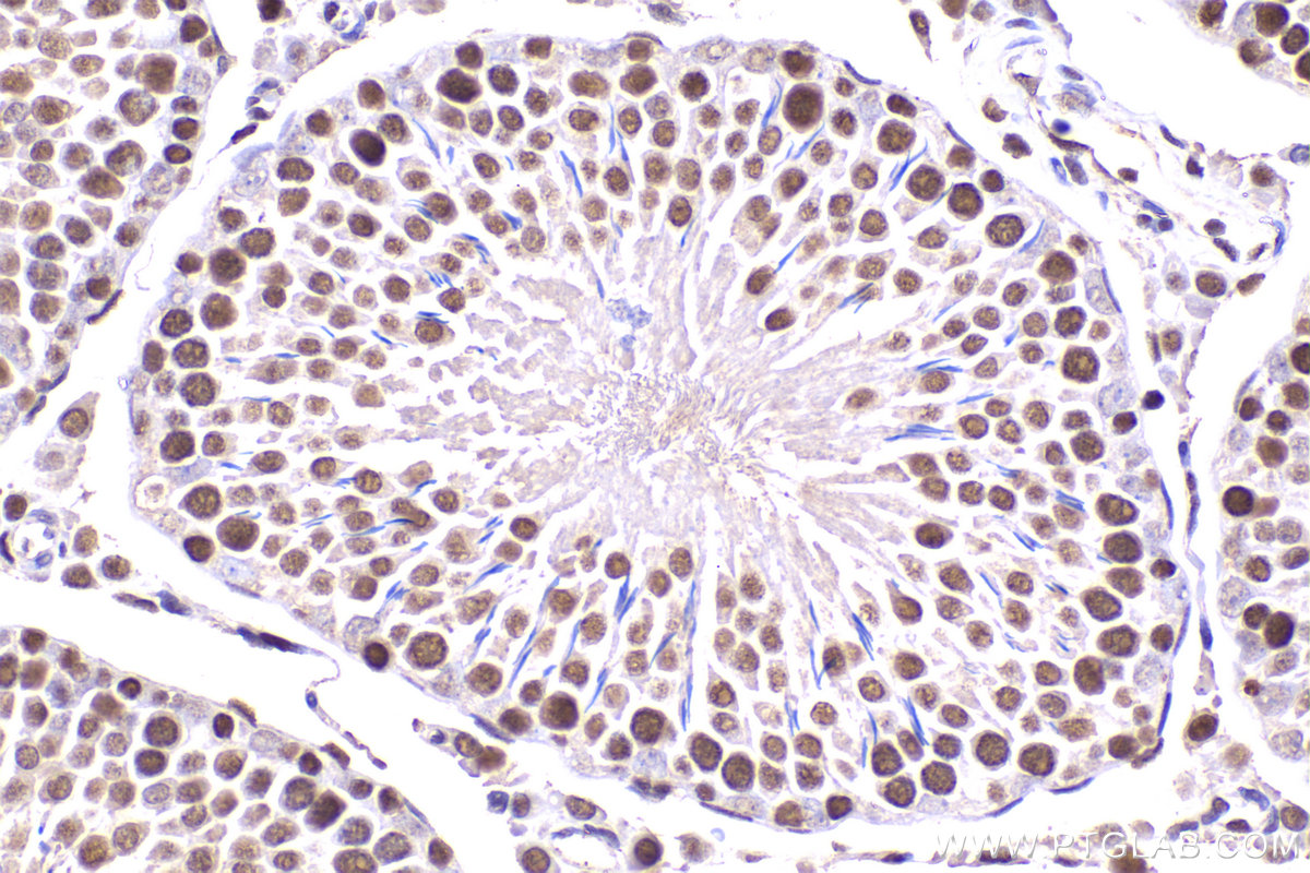 Immunohistochemical analysis of paraffin-embedded rat testis tissue slide using KHC2182 (PCNA IHC Kit).