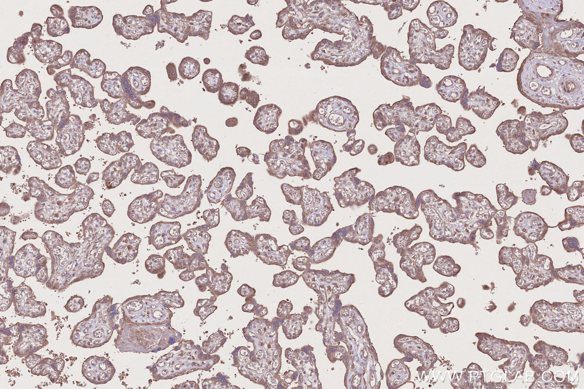 Immunohistochemical analysis of paraffin-embedded human placenta tissue slide using KHC2756 (PCSK5 IHC Kit).